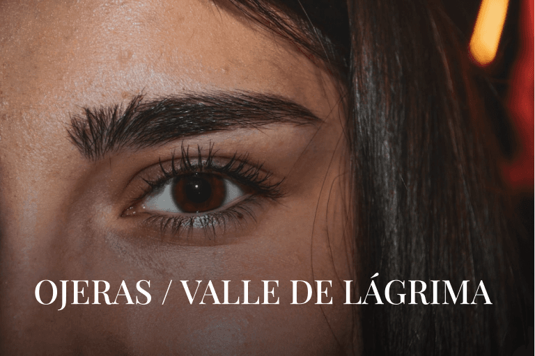OJERAS / VALLE DE LÁGRIMA