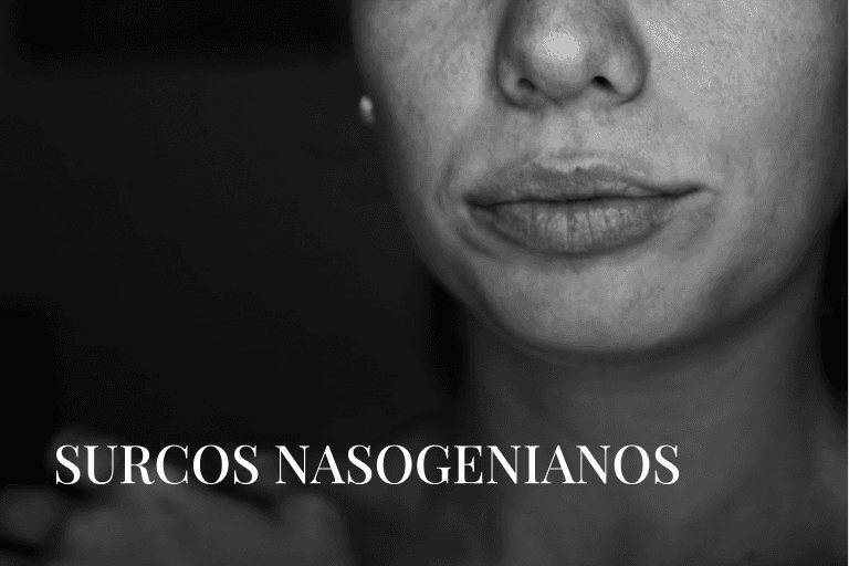 SURCOS NASOGENIANOS
